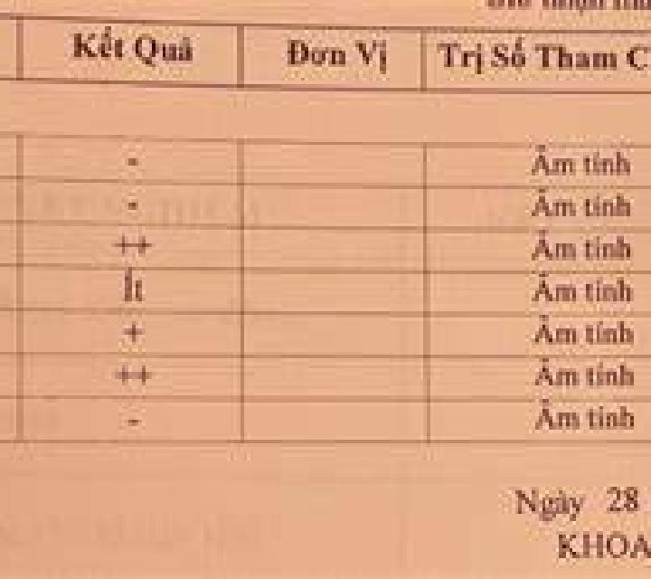 Rosa 2 Rabos escort