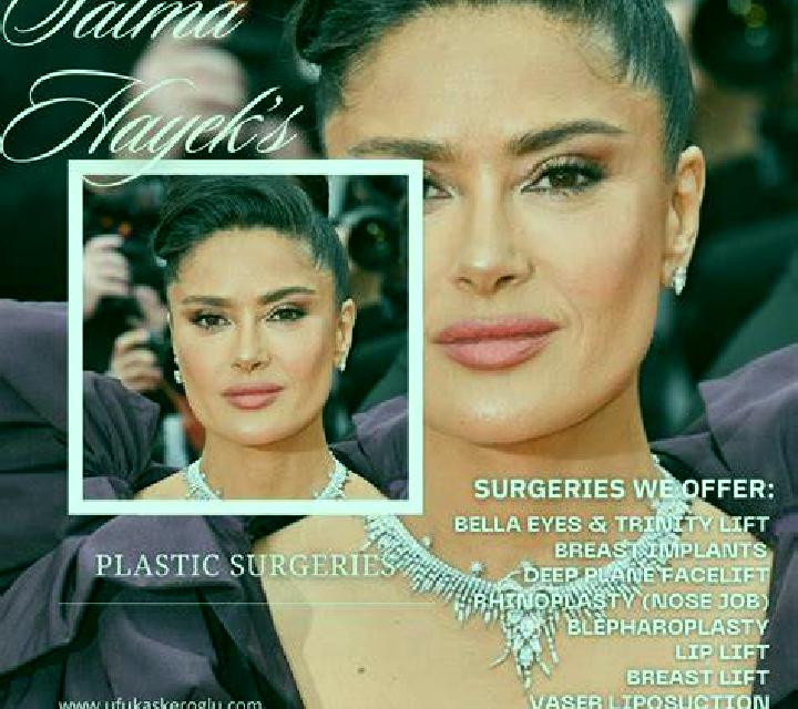 Salma Aldehuela del Codonal escort